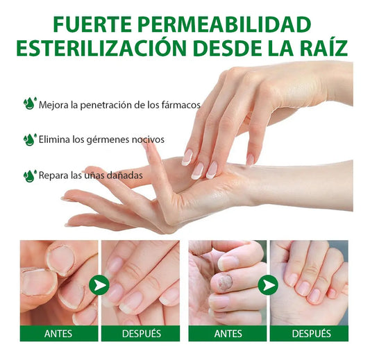 Tratamiento para elimina hongos en 7 días X2 UND. ENVIO GRATIS