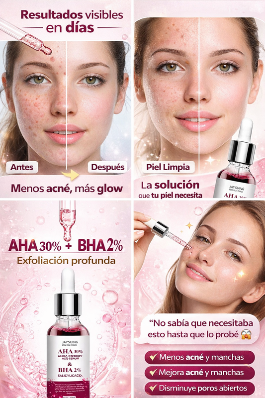 Sérum Facial AHA 30% + BHA 2% | Exfoliante Químico Anti Acné, Manchas y Puntos Negros. ENVÍO GRATIS